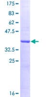 Human ADCY10 / Adenylate Cyclase 10 Protein (Recombinant GST, N-terminus)