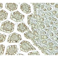 CTHRC1 Antibody