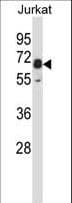 IHC-plus™ Polyclonal Rabbit anti-Mouse PXK Antibody (aa164-193, IHC, WB)