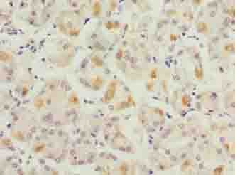 LYSMD1 Antibody