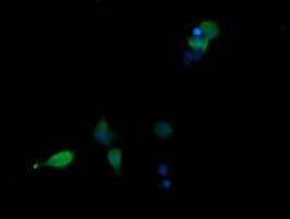 MAPK13 / p38delta Antibody (clone OTI12B2)