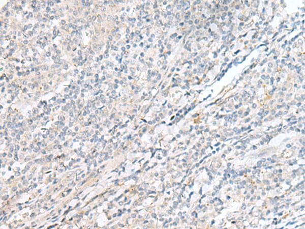 POMGNT1 Antibody