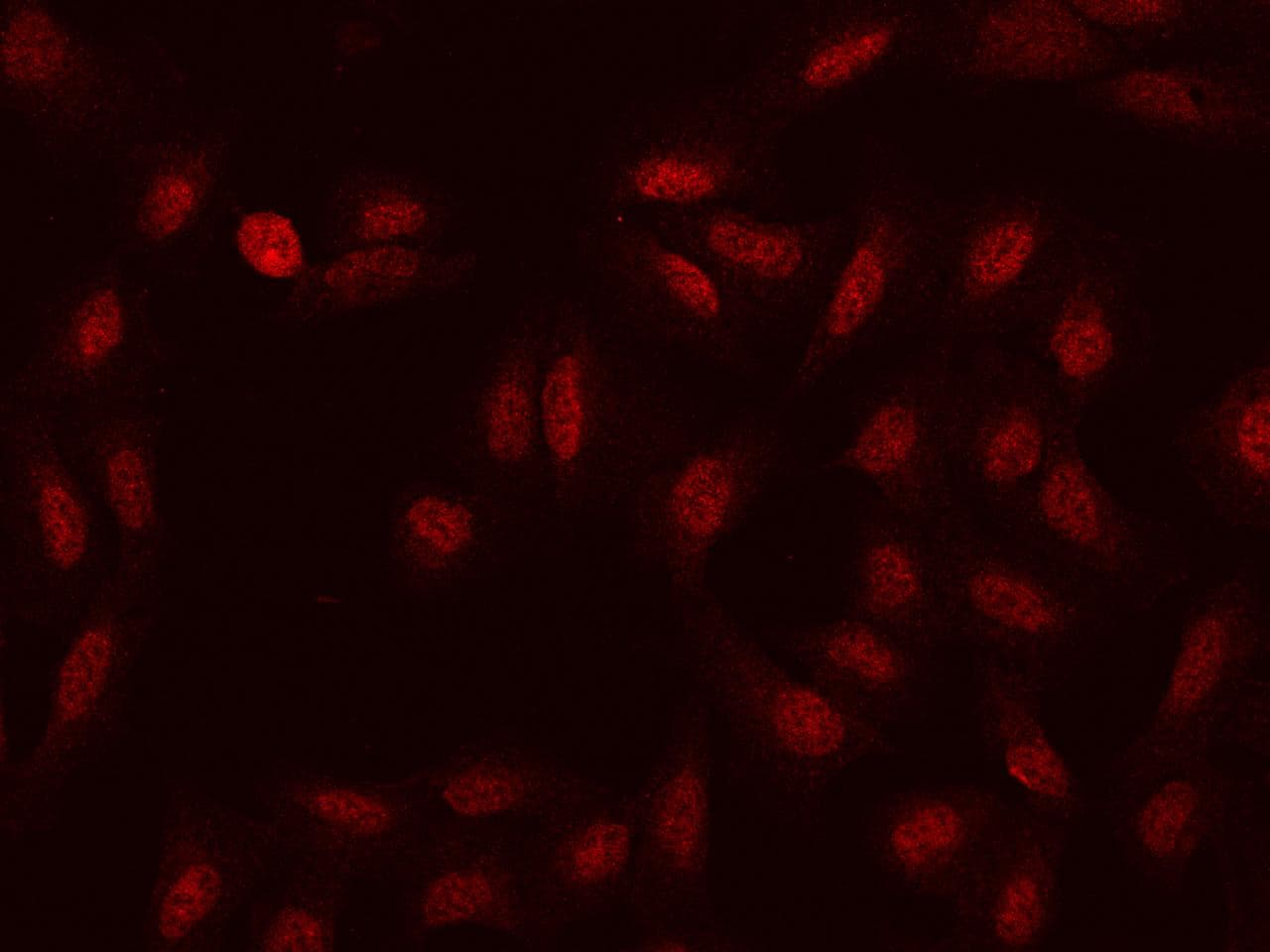 HSD17B6 Antibody