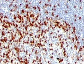 ZAP70 Antibody (clone ZAP70/528 + 2F3.2)
