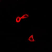 CARS1 / CARS Antibody