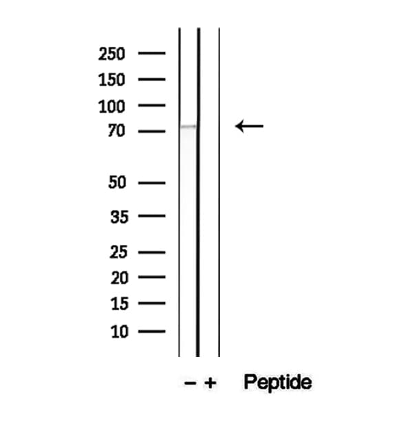 DHX58 / LGP2 Antibody