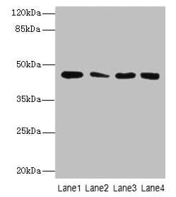 Polyclonal Rabbit anti-Human CBWD2 Antibody