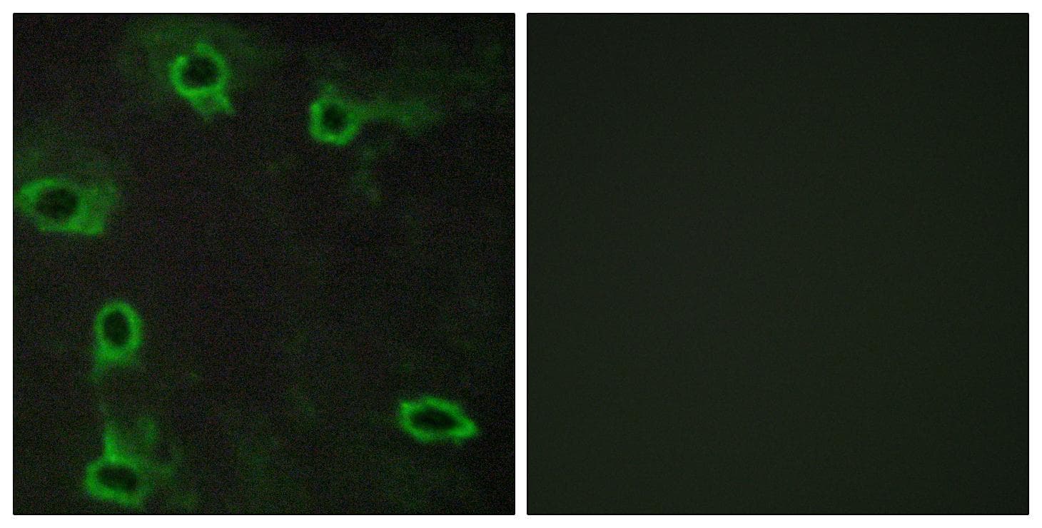 Polyclonal Rabbit anti-Human ADORA2A/Adenosine A2A Receptor Antibody (IHC, IF, WB)
