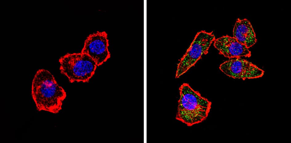 ADRA1A Antibody (3rd intracellular loop)