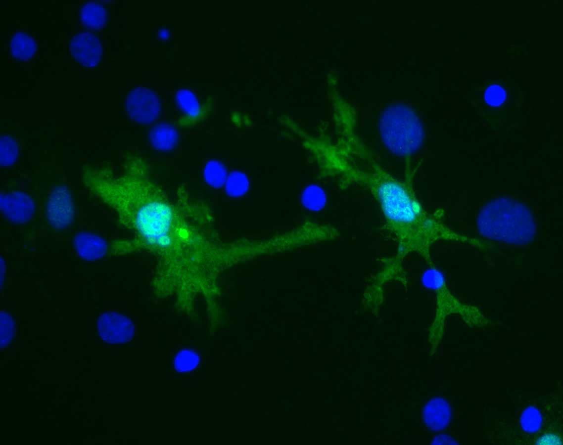 IHC-plus™ LGALS3 / Galectin 3 Antibody (clone 52C1)