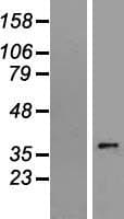 Human SLC35E3 Protein (Over-Expression Lysate Myc-DDK (Flag))