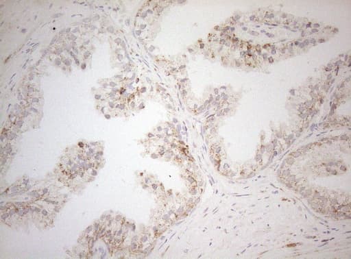 Monoclonal Mouse anti-Human DECR1 Antibody (clone OTI4G4, IHC, WB)