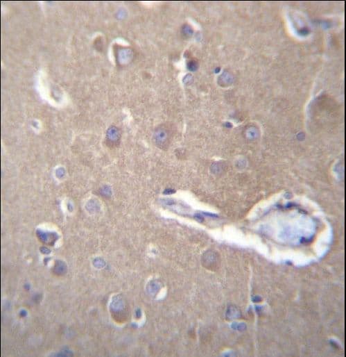 SEC62 / TP-1 Antibody (aa1-30)