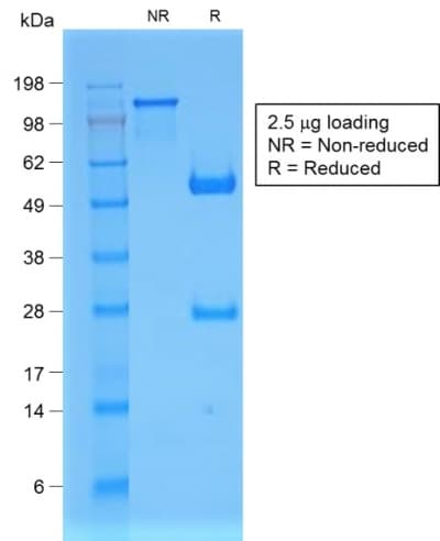 B2M / Beta 2 Microglobulin Antibody (clone B2M/1857R)
