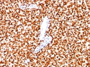 NKX2-2 Antibody (clone SPM564)