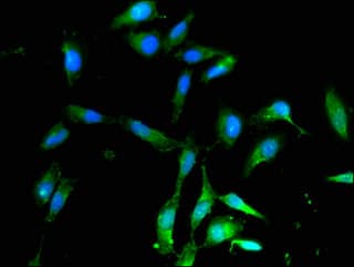 ALDH9A1 Antibody