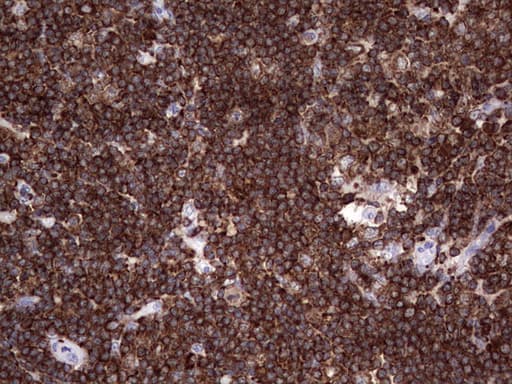DOCK2 Antibody (aa1544-1830, clone OTI4E12)