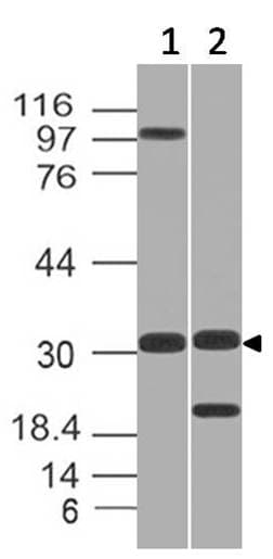 GNPDA1 Antibody