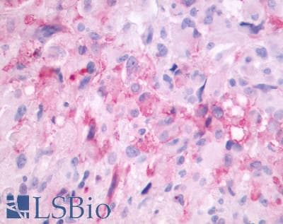 PathPlus™ MTNR1B / MT2 Antibody (Cytoplasmic Domain)