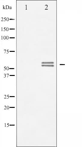 Polyclonal Rabbit anti-Human LYN Antibody (phospho-Tyr508, IHC, IF, WB)