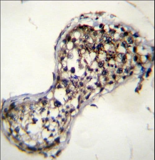 ERG1 / SQLE Antibody (aa68-97)
