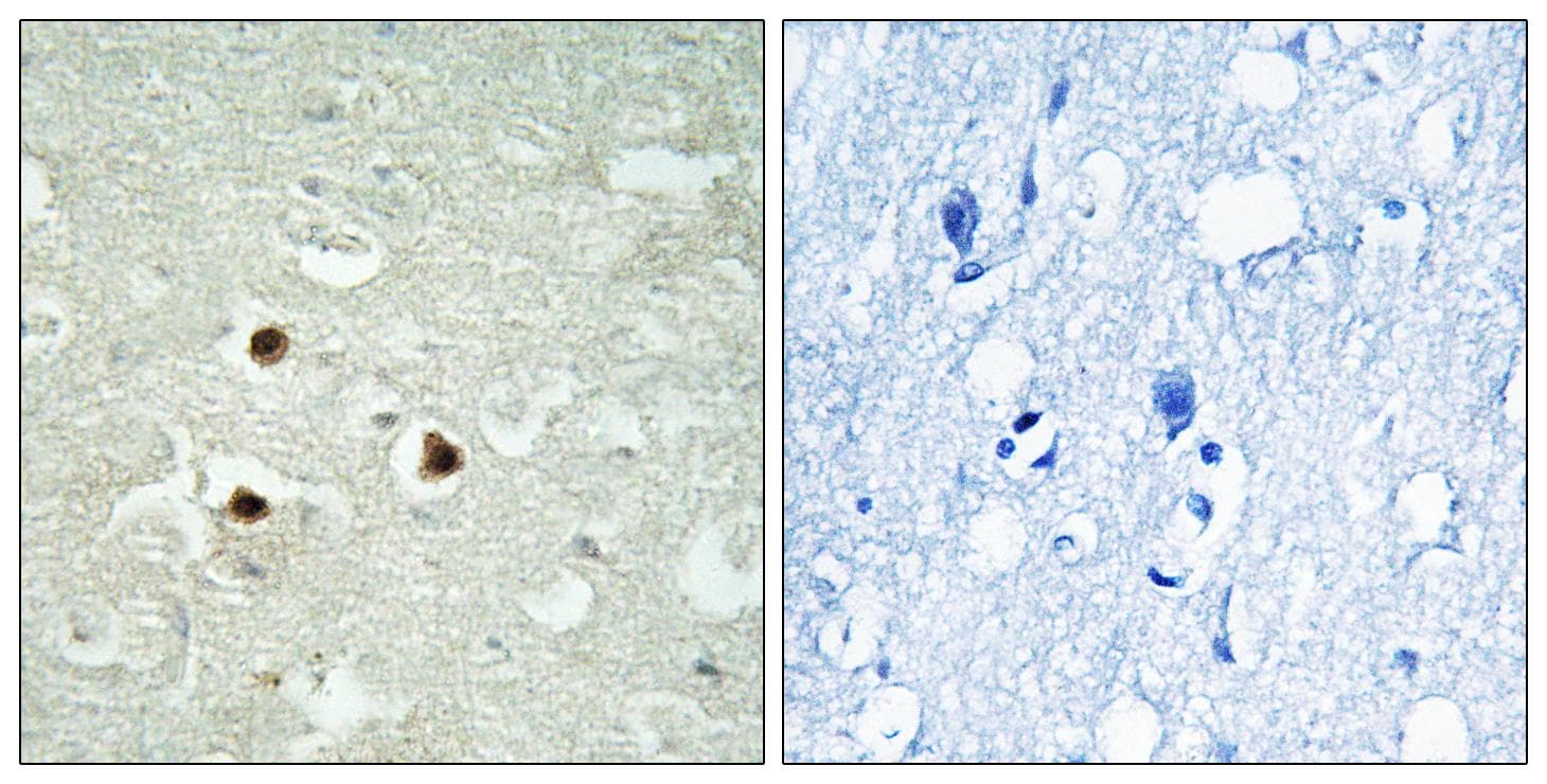RAB3IP / RABIN3 Antibody