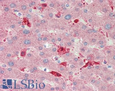 IHC-plus™ Polyclonal Rabbit anti-Human IL11 Antibody (aa22-199, IHC, WB)
