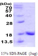 Human UBL4A Protein (Recombinant His)