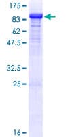 Human DBR1 Protein (Recombinant GST)