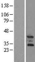 OSCAR Protein (Over-Expression Lysate Myc-DDK (Flag))