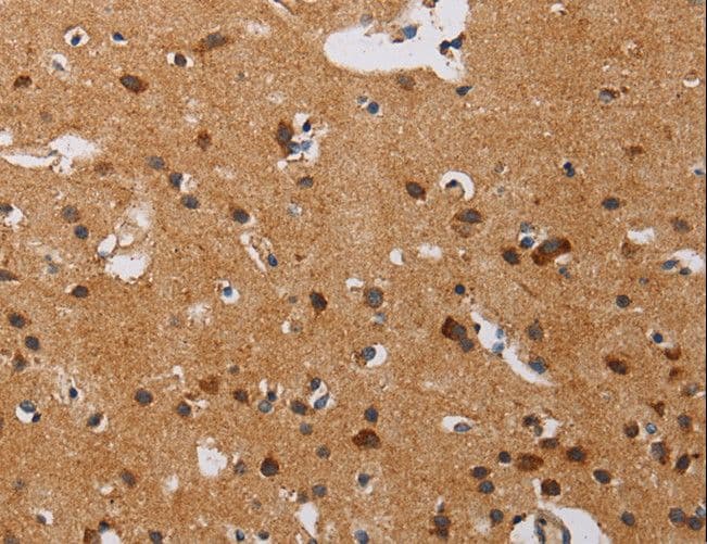 IHC-plus™ IL17RA Antibody