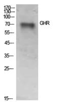 Growth Hormone Receptor / GHR Antibody