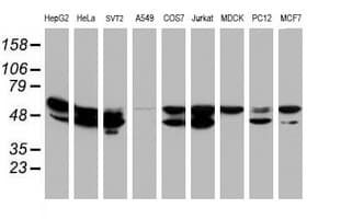 Monoclonal Mouse anti-Human NONO / P54NRB Antibody (clone OTI2E7, IHC, WB)