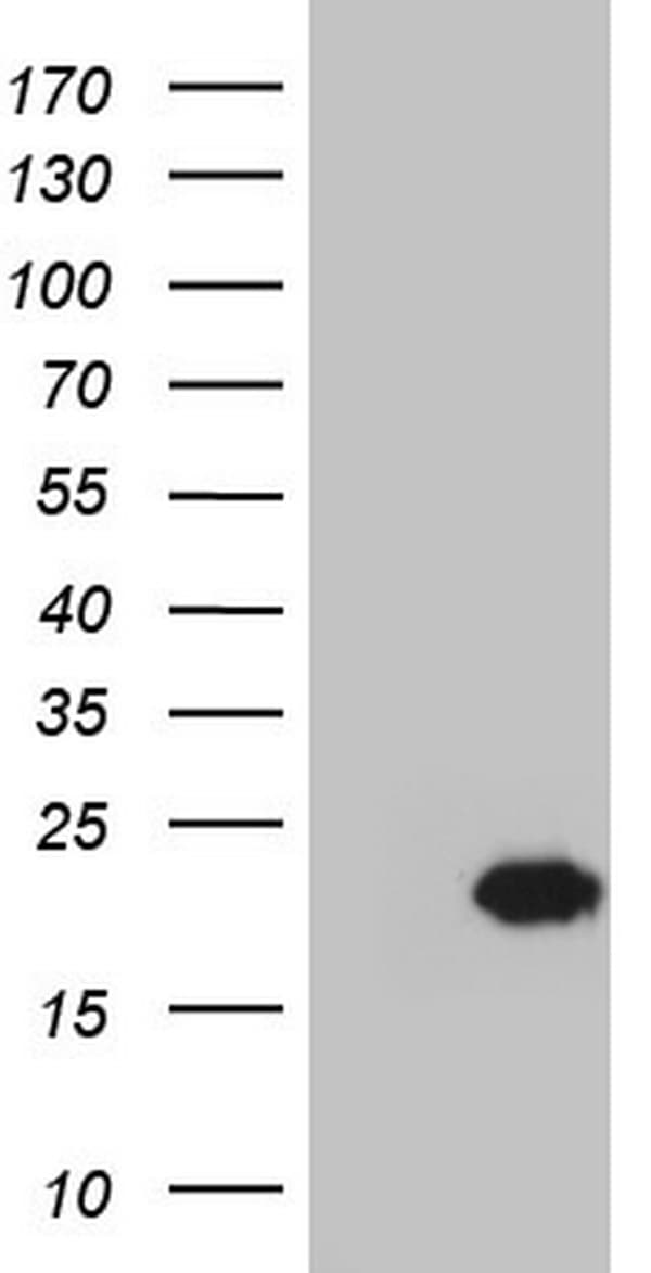 CETN1 Antibody (clone OTI1E1, Carrier-free)