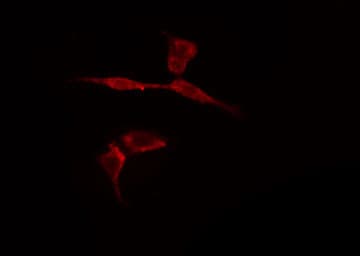 STAT5A Antibody