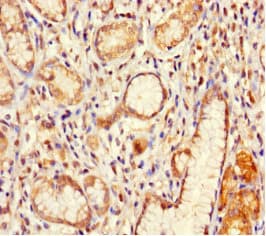 Polyclonal Rabbit anti-Human IFT80 Antibody