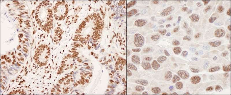 HNRNPK / hnRNP K Antibody (aa300-350)