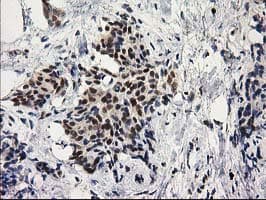 PRKCE / PKC-Epsilon Antibody (clone OTI2A12)