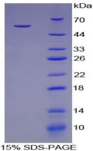 Pig CTSK / Cathepsin K Protein (Recombinant His-GST)