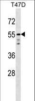 AKT1 Antibody (aa438-468)