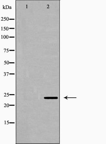 CLDN7 / Claudin 7 Antibody