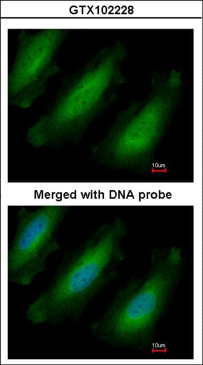 Polyclonal Rabbit anti-Human RPL13A Antibody (aa1-203, IHC, WB)