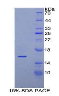 Mouse KLB / Beta Klotho Protein (Recombinant His)