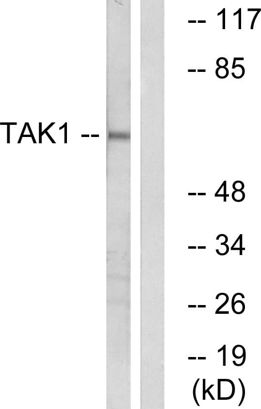 MAP3K7 / TAK1 Antibody (aa161-210)