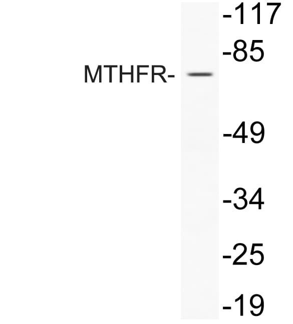 MTHFR Antibody (aa314-363)