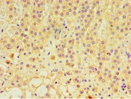 GTF2H2C Antibody (aa1-260)