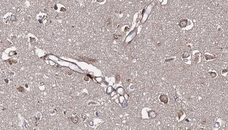 ATL1 Antibody