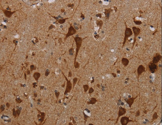 KMT2D / MLL2 Antibody (aa2-14)