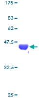 Human NME2 Protein (Recombinant GST)