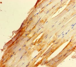 ZBED1 / TRAMP Antibody